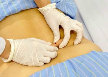 Chích lể là gì? Có tác dụng gì trong điều trị bệnh